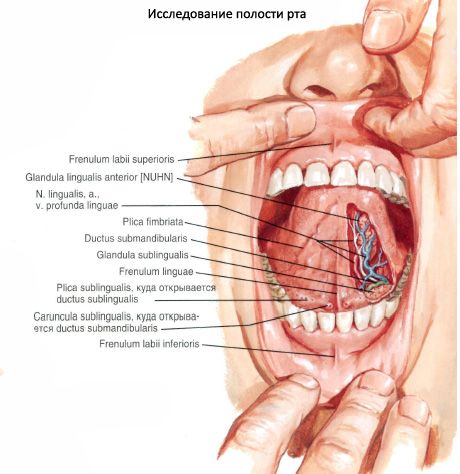 Podjęzykowy gruczoł ślinowy