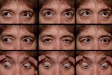 Neuropatia Nerwu Odwodz cego Przyczyny Objawy Diagnoza I Leczenie neuropatia-nerwu-odwodz-cego-przyczyny-objawy-diagnoza-i-leczenie