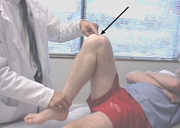 Ból w kolanie podczas zgięcia jest najczęstszym powodem, dla którego ludzie odwiedzają lekarzy urazowych. 