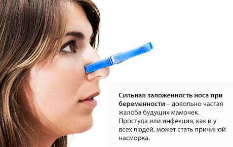 Zatkanie nosa podczas ciąży